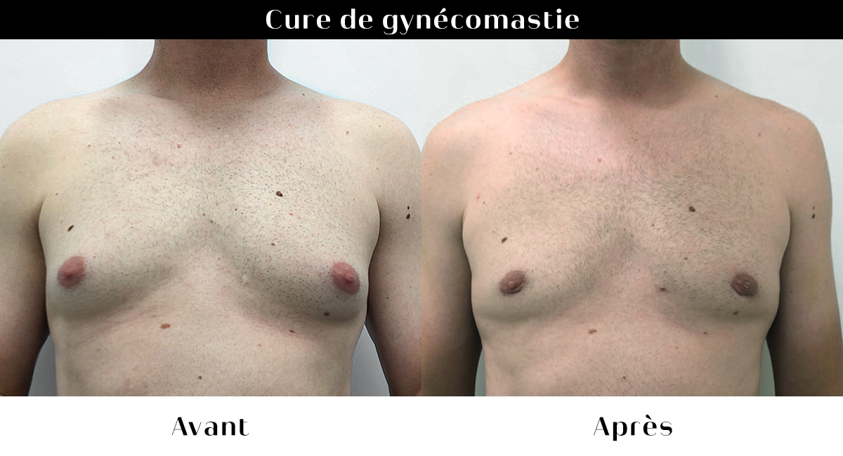 avant apres 30