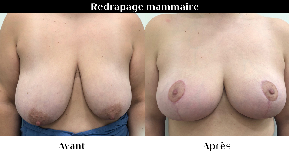 avant apres 60